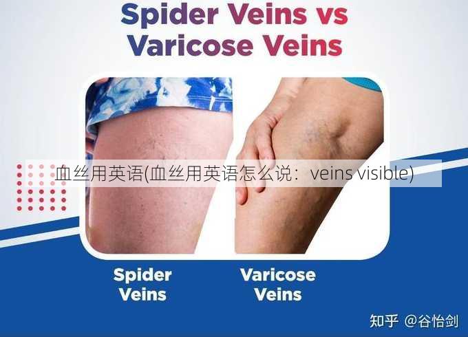 血丝用英语(血丝用英语怎么说：veins visible)